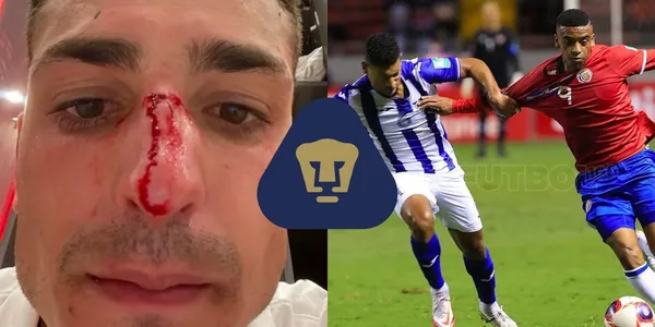 Conoce el jugador que sacaron por agarrase a golpes y quién será su sustituto.
